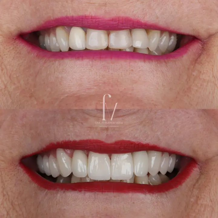 Clinical case published by the practice, showing a smile before and after treatment