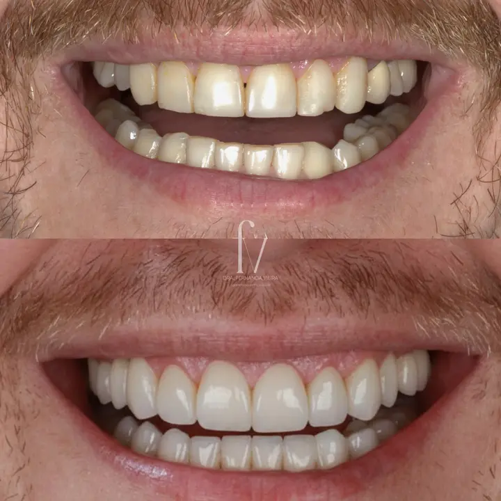 Clinical case published by the practice, showing a smile before and after treatment