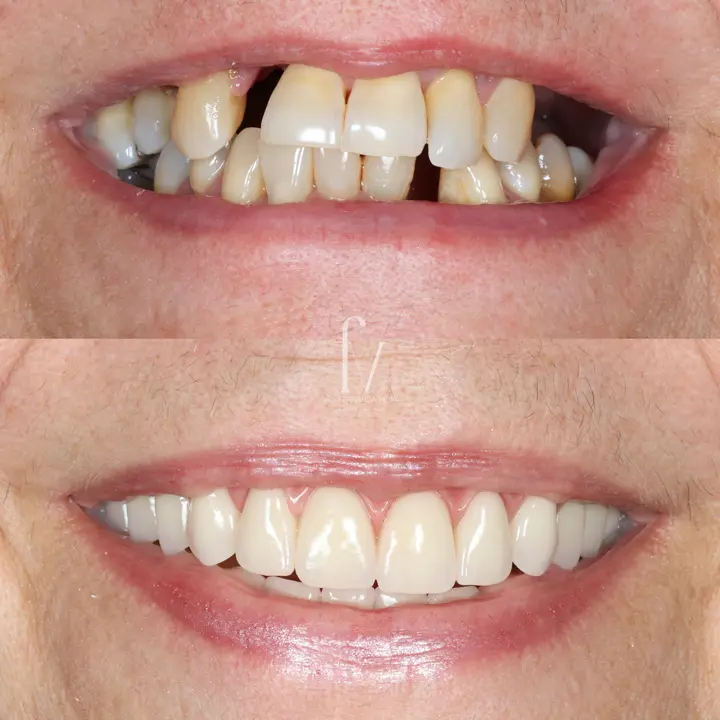 Clinical case published by the practice, showing a smile before and after treatment